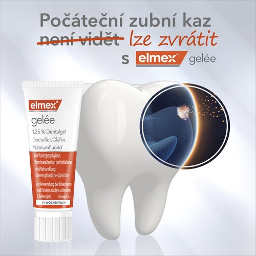 Návod k použití zubního gelu s jednotlivými kroky aplikace.